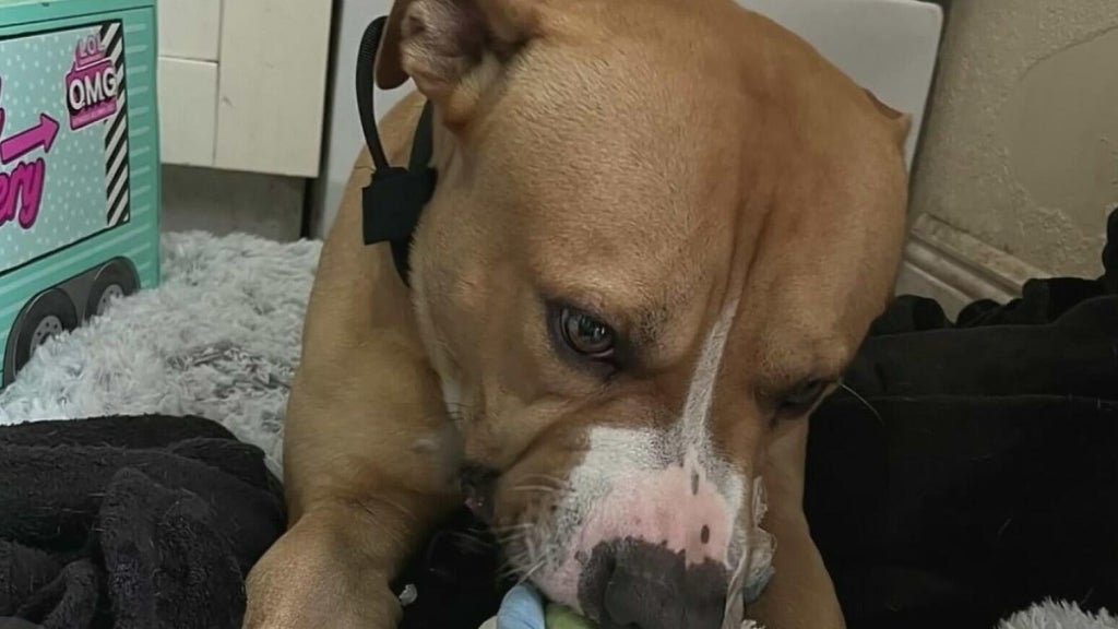 Teen girl remains hospitalized after dog attack in northwest Miami-Dade; owner surrenders pit bull — CBS Miami, Miami Health news